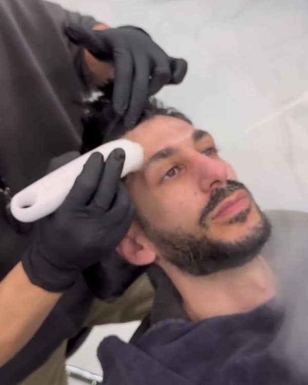 Περιποίηση προσώπου στο Drip, καθαρισμός με συσκευή